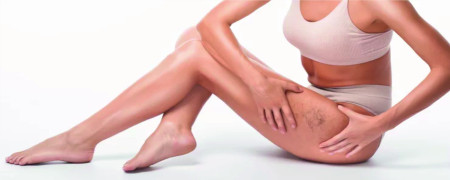 Circulation, jambes lourdes? Cyprès Houx Vigne Rouge, Marron